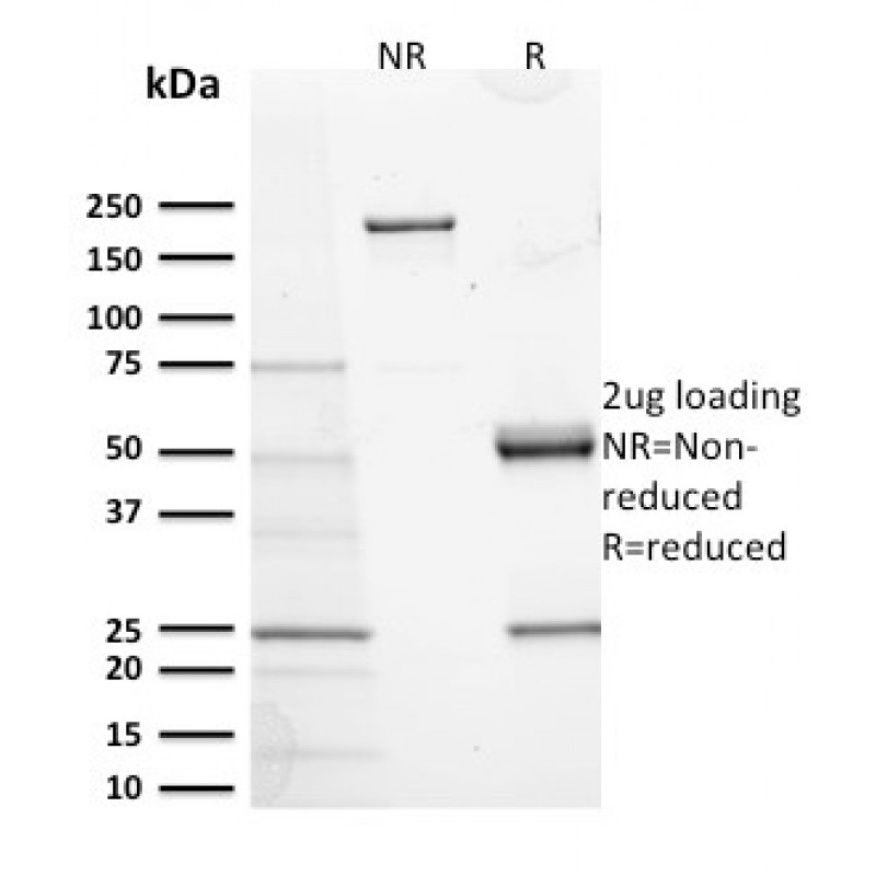 Biotium BNC042673-500, CD117 / c-Kit (Marker for Gastrointestinal Stromal Tumors)(KIT/2673), CF405S conjugate, 0.1mg/mL