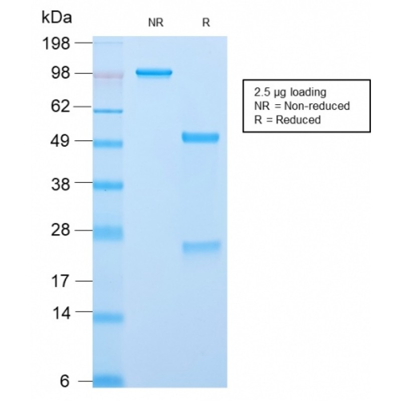 Biotium BNC042859-100, ACTH (Adrenocorticotrophic Hormone) (C-Terminus)(CLIP/2859R), CF405S conjugate, 0.1mg/mL
