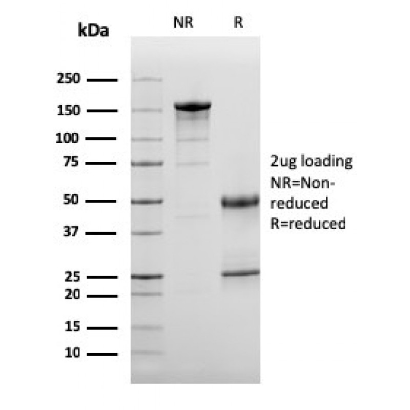 Complement 3d (C3d) (Acute Humoral Rejection Marker)(C3D/2891), CF405S conjugate, 0.1mg/mL