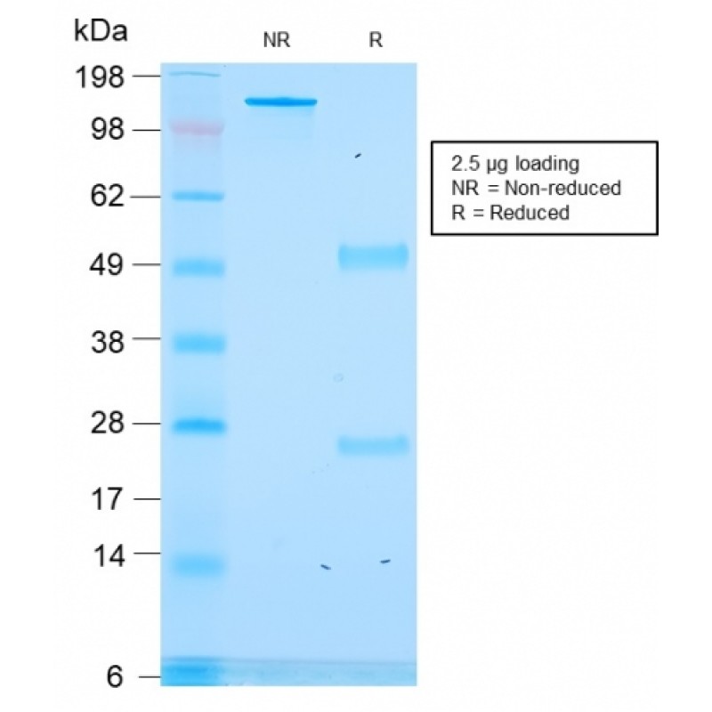 Biotium BNC043176-100, ACTH (Adrenocorticotrophic Hormone) (C-Terminus)(rCLIP/1418), CF405S conjugate, 0.1mg/mL