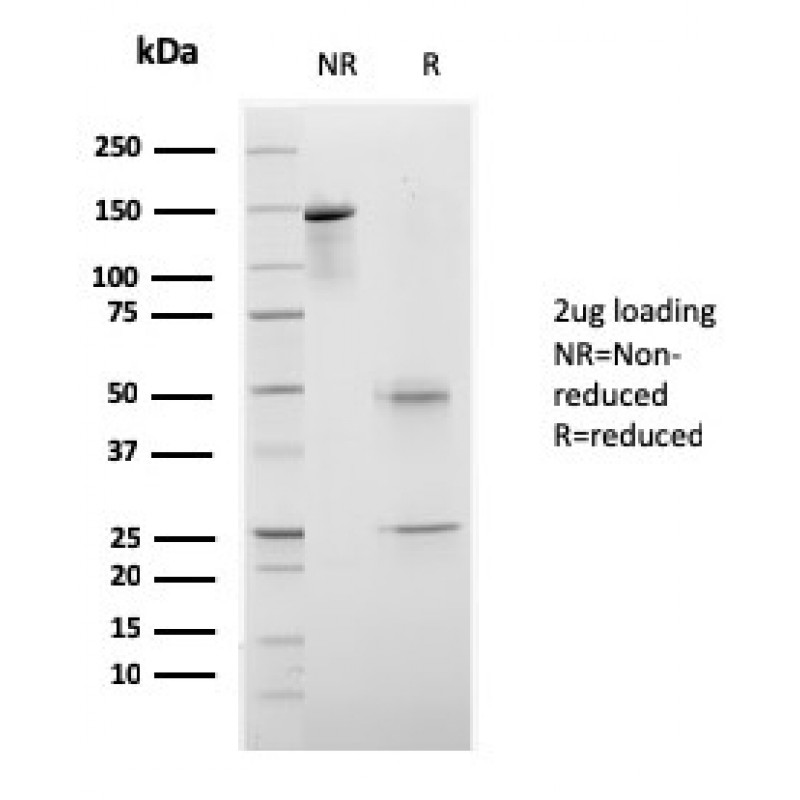 CELA3B / ELA3B (Pancreatic Function Marker)(rCELA3B/1811), CF405S conjugate, 0.1mg/mL