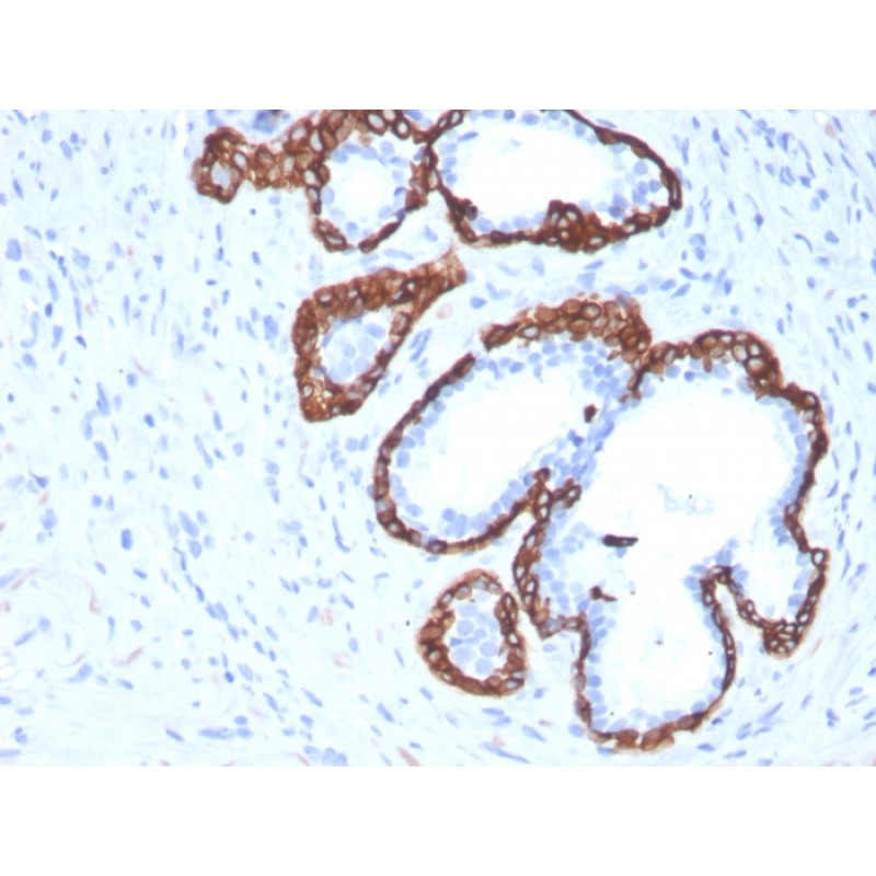 Cytokeratin 5 (KRT5) (Basal, Myoepithelial & Mesothelial Cell Marker)(KRT5/3594), CF405S conjugate, 0.1mg/mL