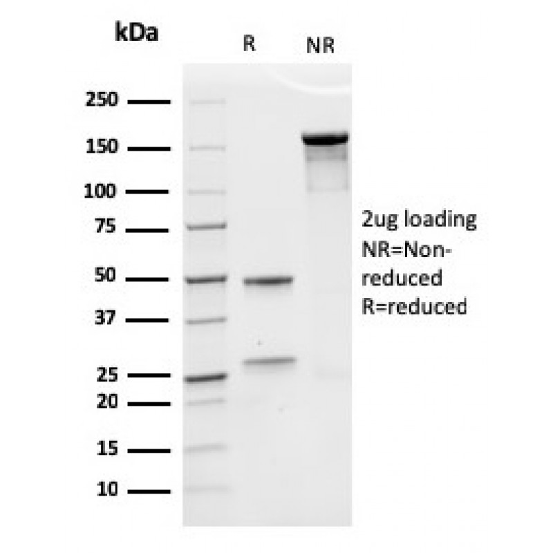 Erythropoietin (EPO) (Marker of Placentation Disorders)(rEPO/1367), CF405S conjugate, 0.1mg/mL