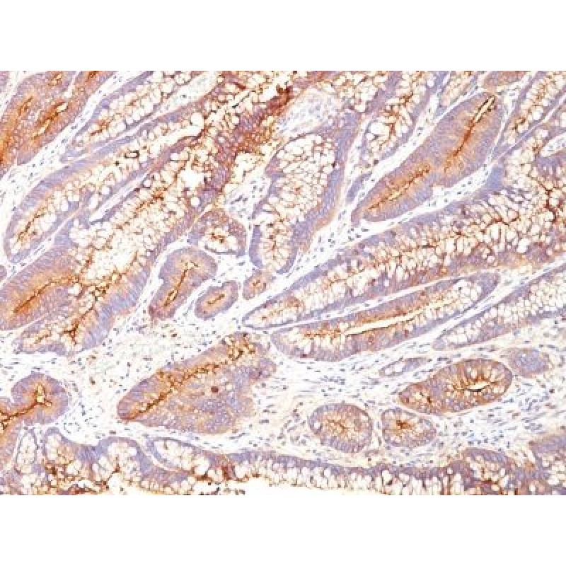 CD66 (CEA)(COL-1), CF640R conjugate, 0.1mg/mL