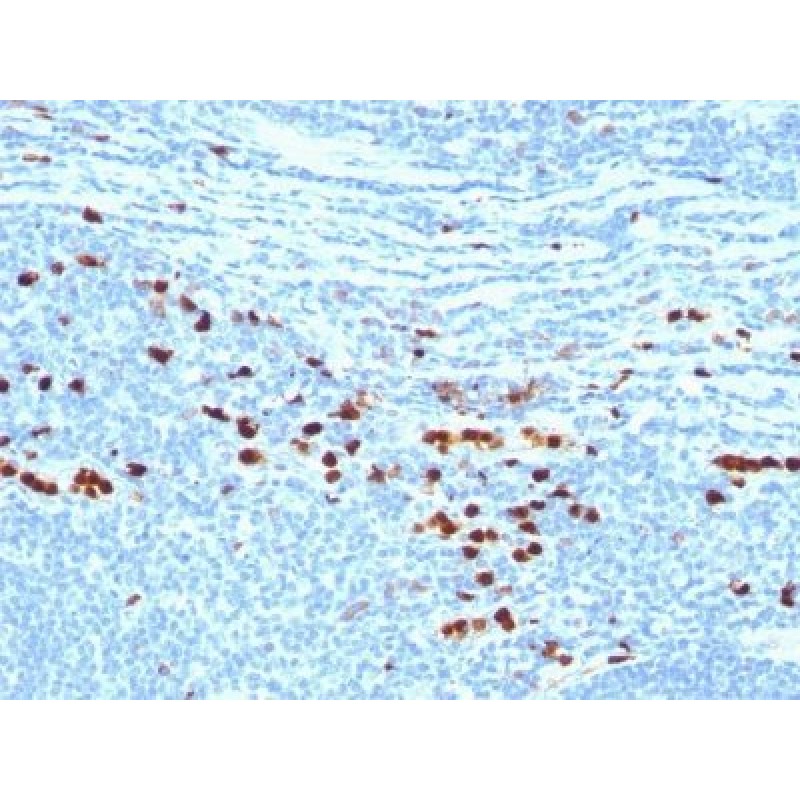 Calgranulin B / MRP-8/-14 / MAC 387 / S100A8/A9 / Macrophage Ag(MAC387), CF640R conjugate, 0.1mg/mL