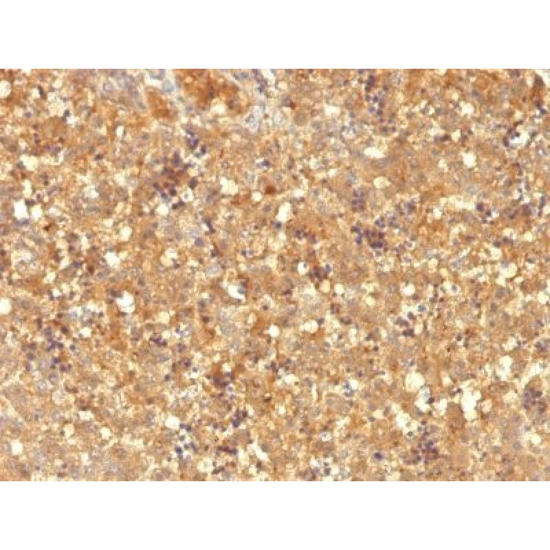 AFP (Alpha Fetoprotein)(MBS-12), CF640R conjugate, 0.1mg/mL