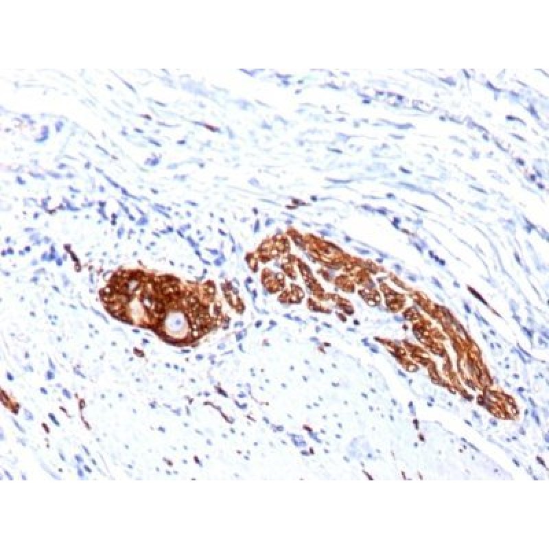CD56 / NCAM(123C3.D5 + 123A8), CF640R conjugate, 0.1mg/mL