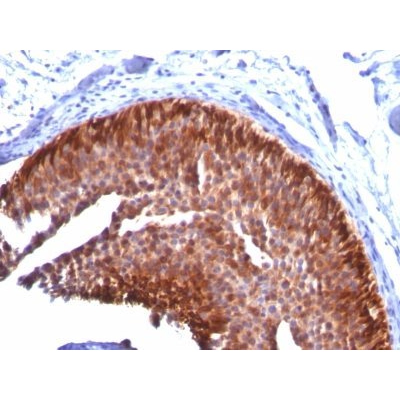 Cytokeratin 17(KRT17/778), CF640R conjugate, 0.1mg/mL