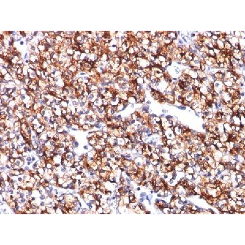 Carbonic Anhydrase IX(CA9/781), CF640R conjugate, 0.1mg/mL