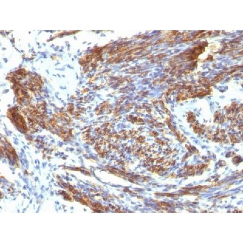 Caldesmon, HMW (h-Caldesmon)(CALD1/820), CF640R conjugate, 0.1mg/mL
