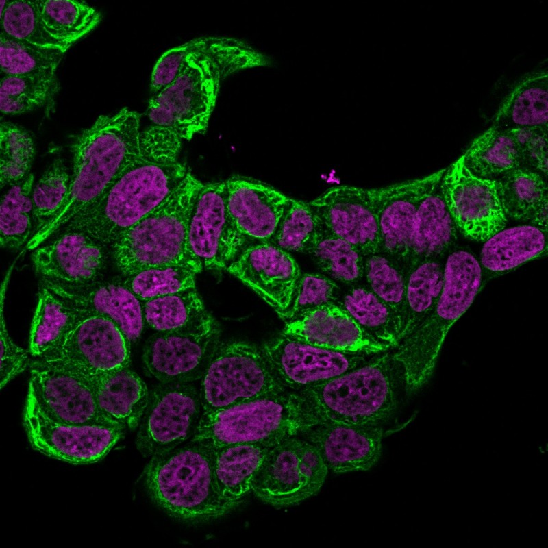 Cytokeratin 18(KRT18/834), CF640R conjugate, 0.1mg/mL