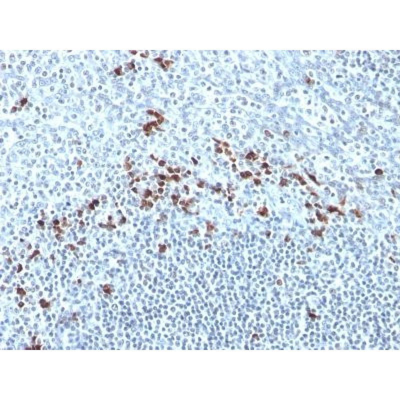 Human Kappa Light Chain(Kap-56), CF640R conjugate, 0.1mg/mL