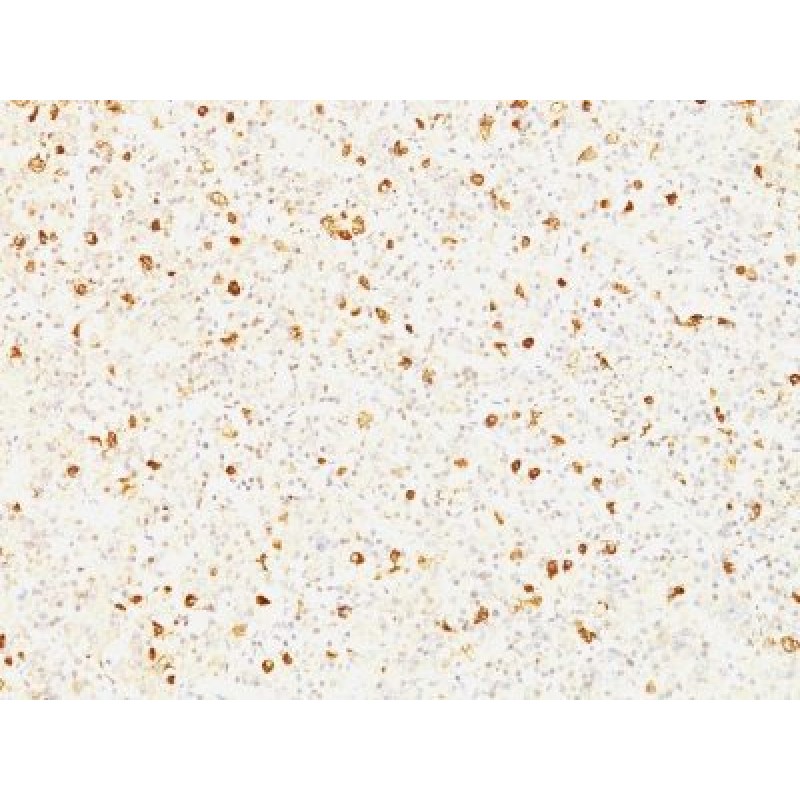 Luteinizing Hormone beta (LH beta)(LHb/1214), CF640R conjugate, 0.1mg/mL