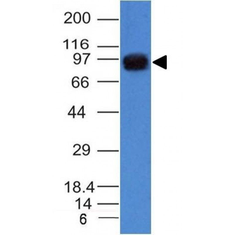 UACA / Nucling(UACA/1222), CF640R conjugate, 0.1mg/mL