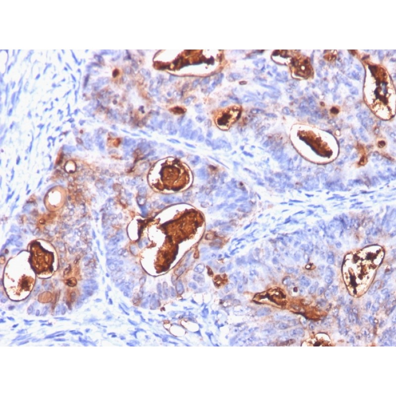 Carcinoembryonic Antigen (CEA) / CD66(C66/1260), CF640R conjugate, 0.1mg/mL