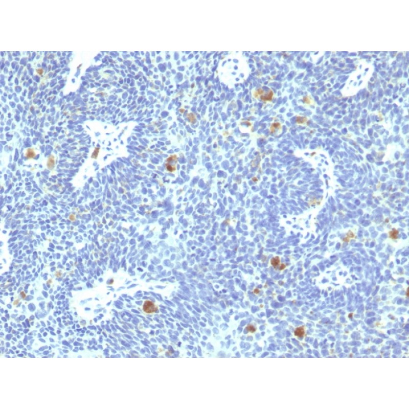 HPV-16 (Human Papilloma Virus 16)(HPV16/1295), CF640R conjugate, 0.1mg/mL