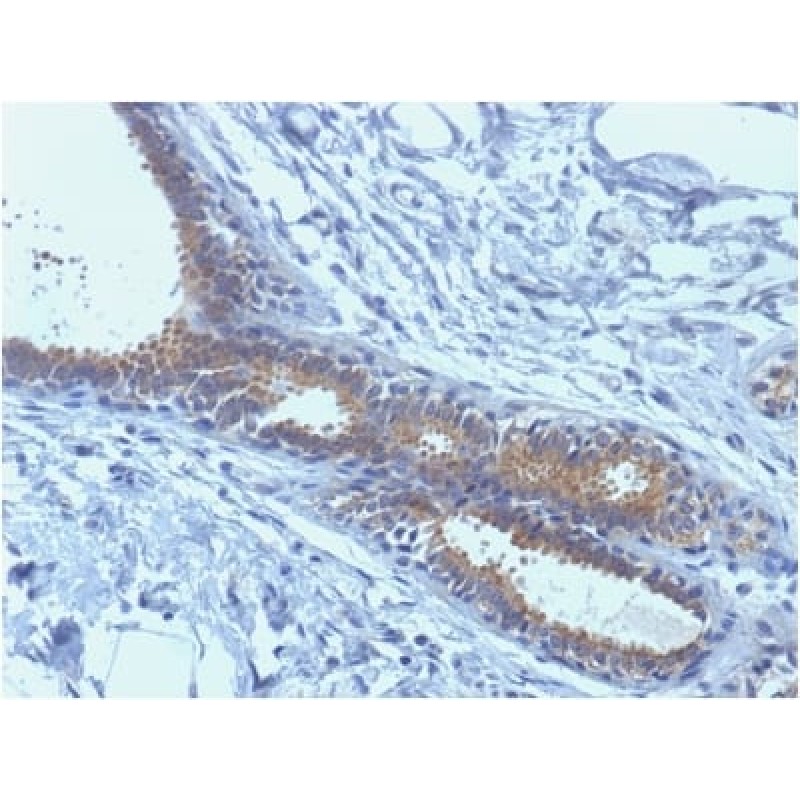 BRCA1 (Breast Marker) (BRCA1/1398), CF640R conjugate, 0.1mg/mL