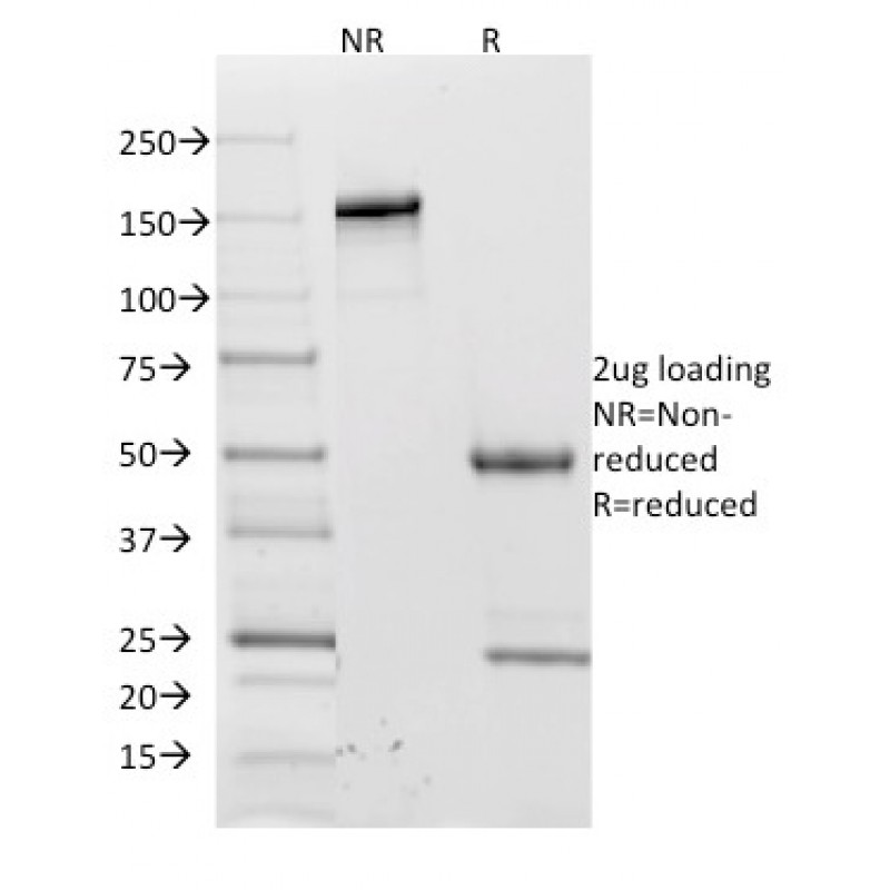 CD62L (L-Selectin)(CD62L/1588), CF640R conjugate, 0.1mg/mL