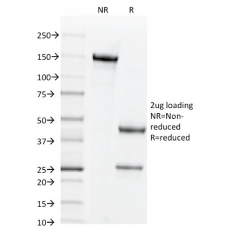 CD44v6 (Marker of Tumor Metastasis)(2F10), CF640R conjugate, 0.1mg/mL
