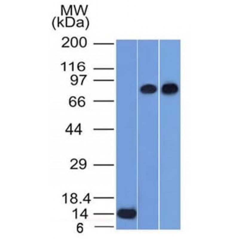 p63 (Squamous, Basal and Myoepithelial Cell Marker) (TP63/1786), CF640R conjugate, 0.1mg/mL