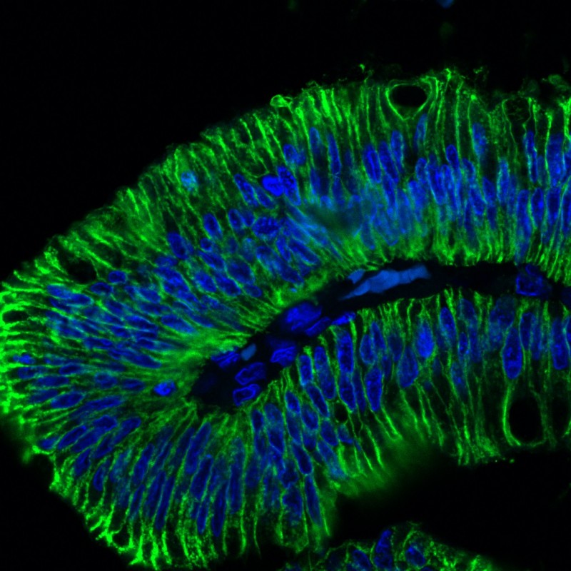 Ep-CAM / CD326 (Extracellular Domain) (Epithelial Marker) (EGP40/1798), CF640R conjugate, 0.1mg/mL