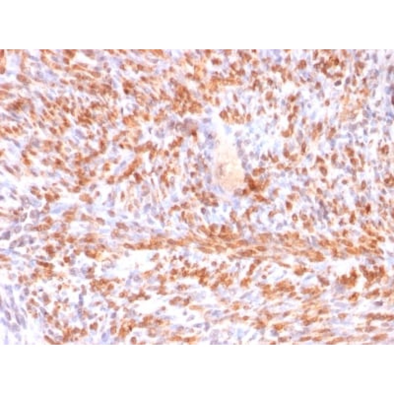 Calponin-1 (Smooth Muscle Marker) (rCNN1/832), CF640R conjugate, 0.1mg/mL