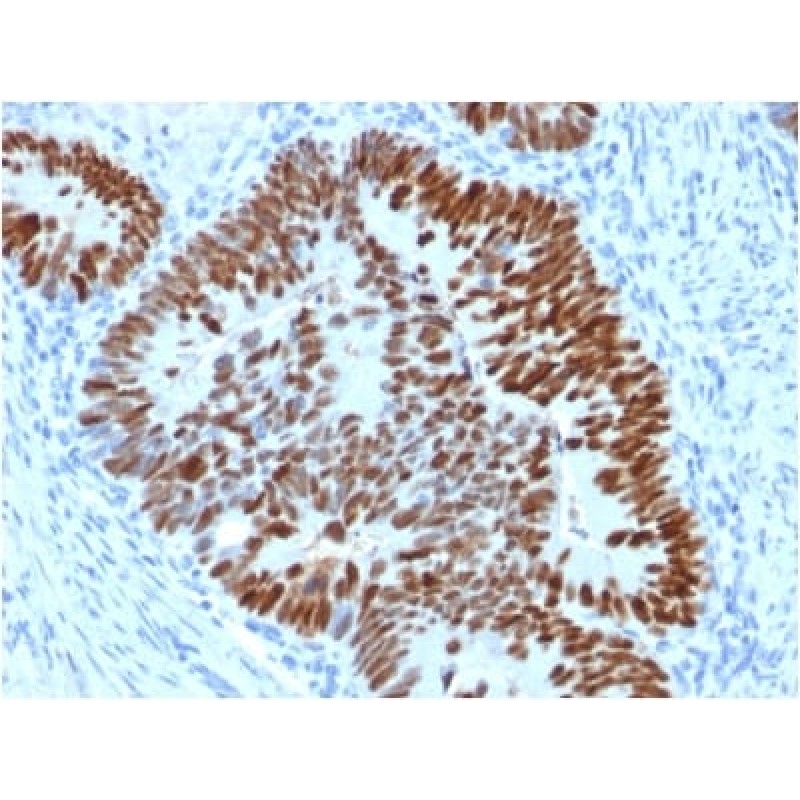 p53 Tumor Suppressor Protein (PCRP-TP53-2A10), CF640R conjugate, 0.1mg/mL