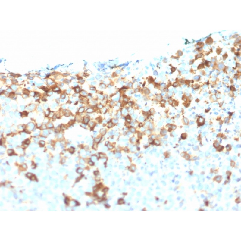 NGF-Receptor (p75) / CD271 (Soft Tissue Tumor Marker) (NGFR/1964), CF640R conjugate, 0.1mg/mL