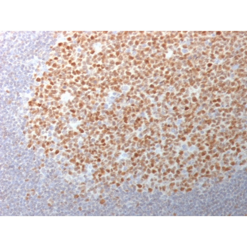 Biotium BNC401982-100, Bcl-6 (Follicular Lymphoma Marker) (BCL6/1982), CF640R conjugate, 0.1mg/mL