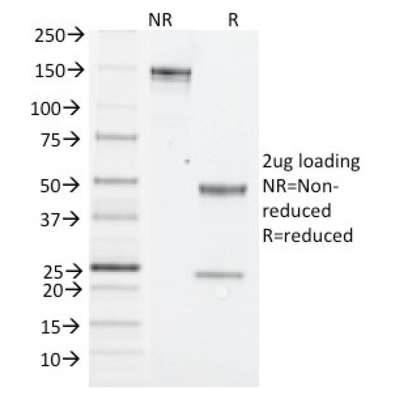 NK1.1 / CD161c / Klrb1c, Mouse(PK136), CF640R conjugate, 0.1mg/mL