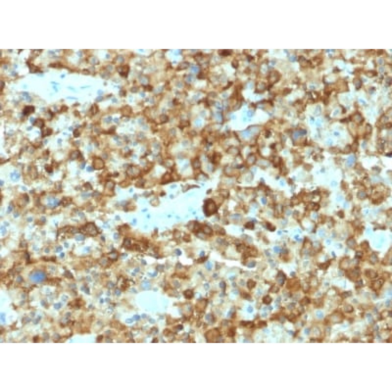 gp100 / Melanosome / PMEL17 / SILV (Melanoma Marker) (PMEL/2037), CF640R conjugate, 0.1mg/mL
