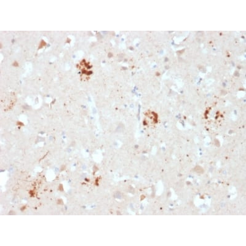 Ubiquitin (Autophagy Marker) (UBB/2122), CF640R conjugate, 0.1mg/mL