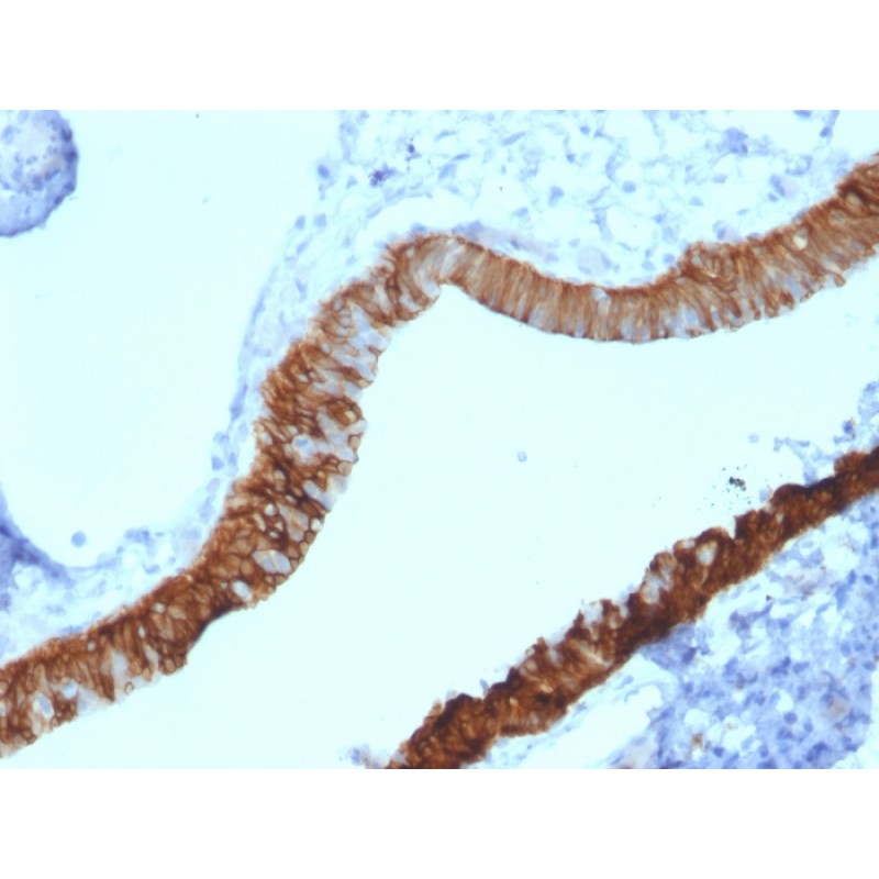 Cytokeratin 3 (KRT3) (Corneal Epithelial Marker)(KRT3/2130), CF640R conjugate, 0.1mg/mL