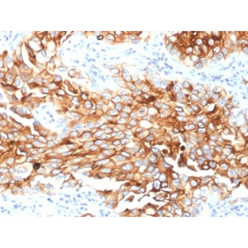 Mesothelin (Mesothelial Marker) (MSLN/2131), CF640R conjugate, 0.1mg/mL
