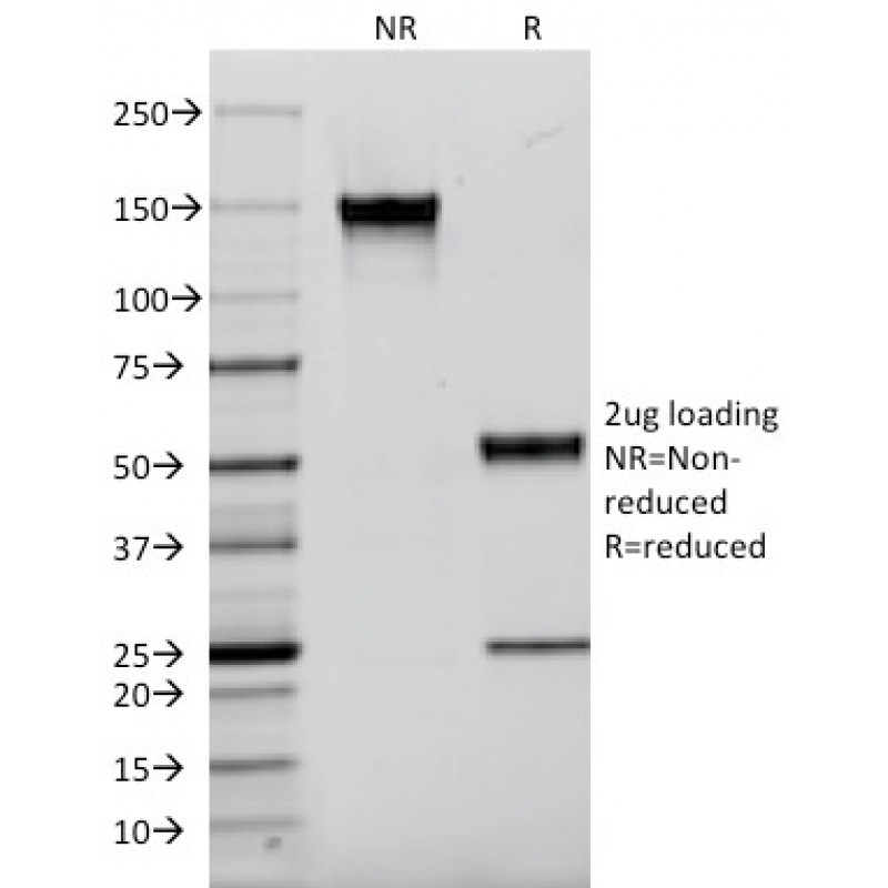 EGFR (Epidermal Growth Factor Receptor)(F4), CF640R conjugate, 0.1mg/mL