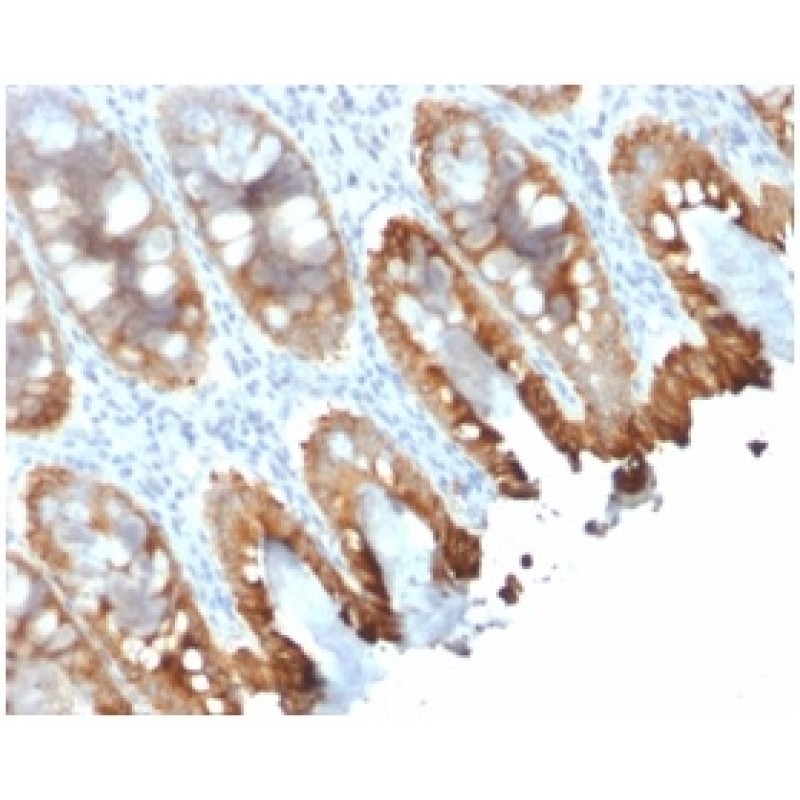 Cytokeratin 8/18(rKRT8.18/1346), CF640R conjugate, 0.1mg/mL