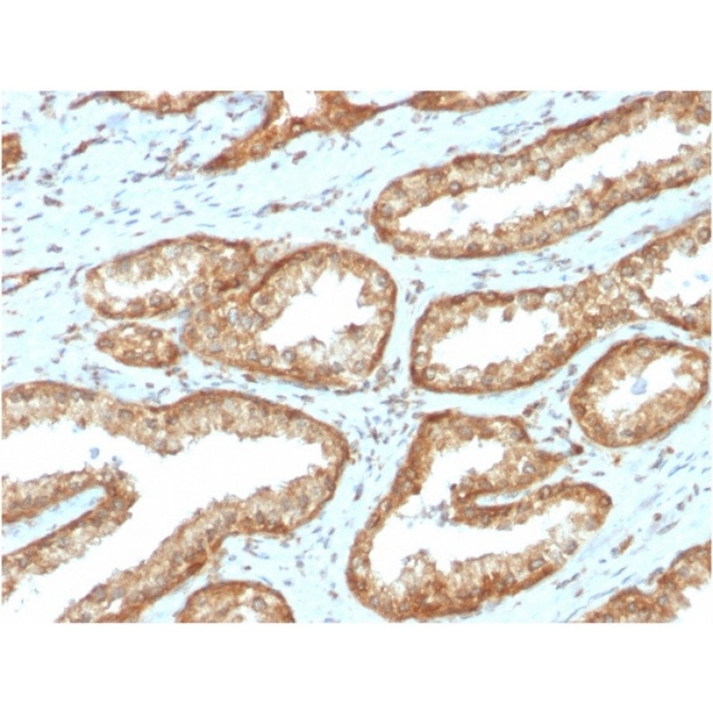YBX1 / Y-box Binding Protein 1 / YB-1 (Tumor Biomarker)(YBX1/2430), CF640R conjugate, 0.1mg/mL
