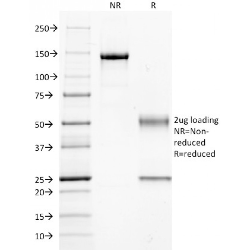 Guanine nucleotide-binding protein alpha-q / GNAQ / G-ALPHA-q(GNAQ/2434), CF640R conjugate, 0.1mg/mL