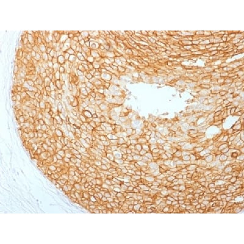 HER-2 / c-erbB-2 / neu / CD340 (ERBB2/2453), CF640R conjugate, 0.1mg/mL