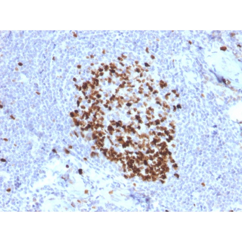 Ki-67 (Proliferating Cell Marker)(MKI67/2466), CF640R conjugate, 0.1mg/mL