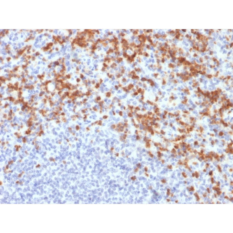 MMP9 (Matrix Metalloproteinase 9)(MMP9/2477), CF640R conjugate, 0.1mg/mL