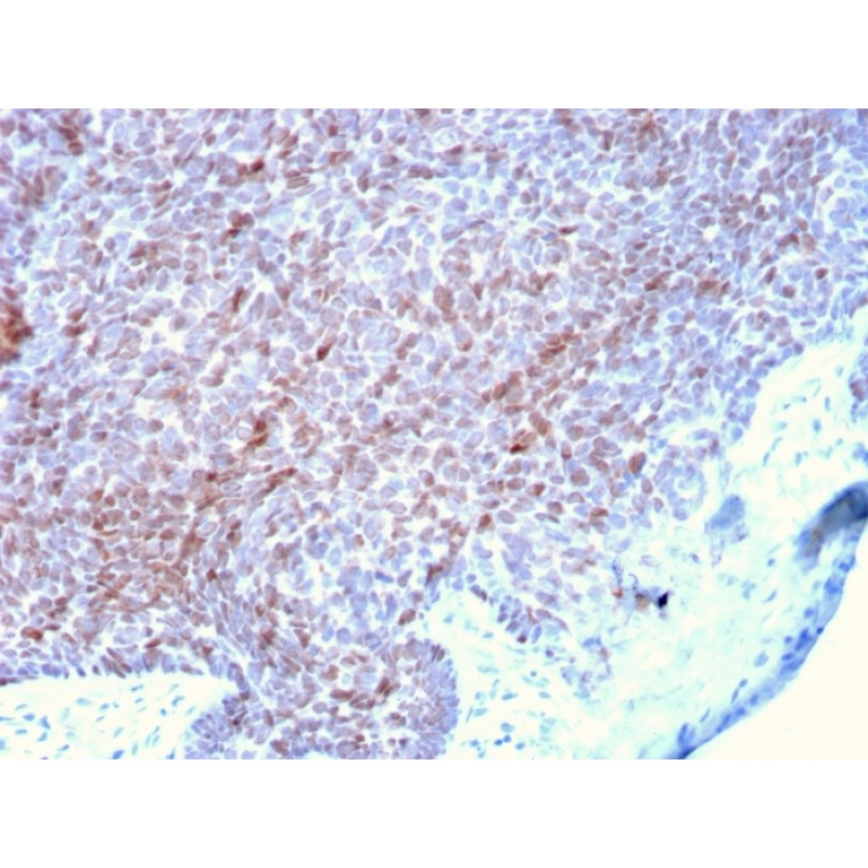 p73 (Tumor Suppressor)(P73/2531), CF640R conjugate, 0.1mg/mL