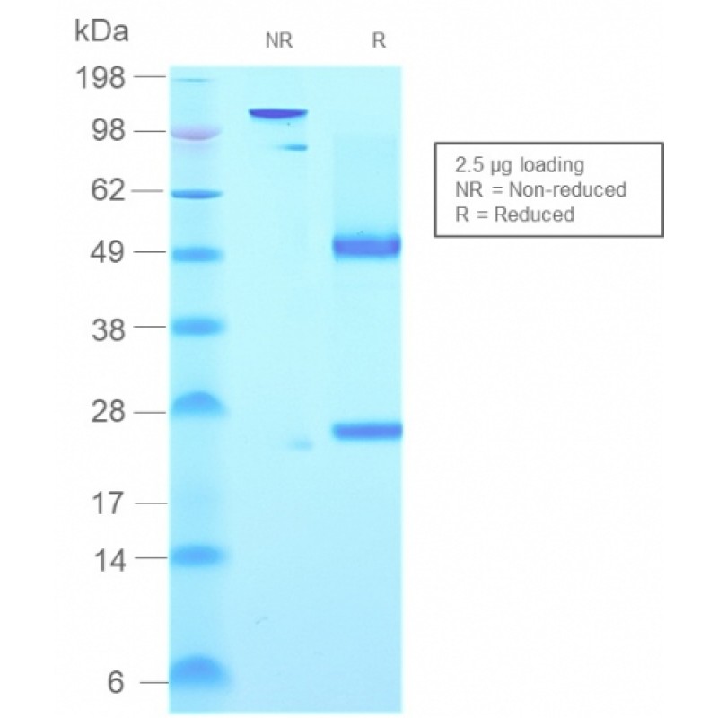 Human IgM (Immunoglobulin Mu Heavy Chain) (B-Cell Marker)(rIGHM/2558), CF640R conjugate, 0.1mg/mL