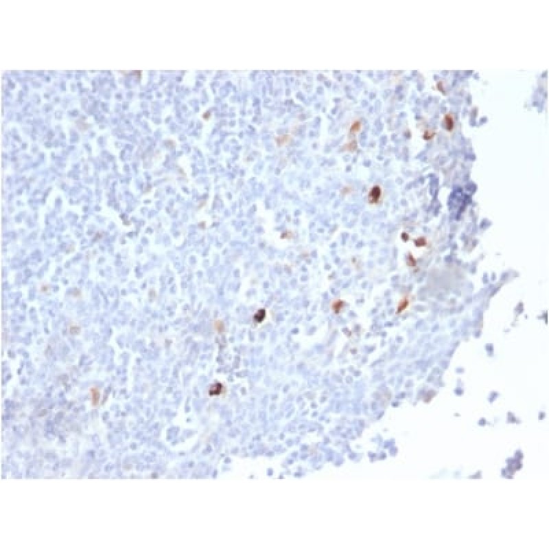Human IgM (Immunoglobulin Mu Heavy Chain) (B-Cell Marker) (IGHM/2559R), CF640R conjugate, 0.1mg/mL