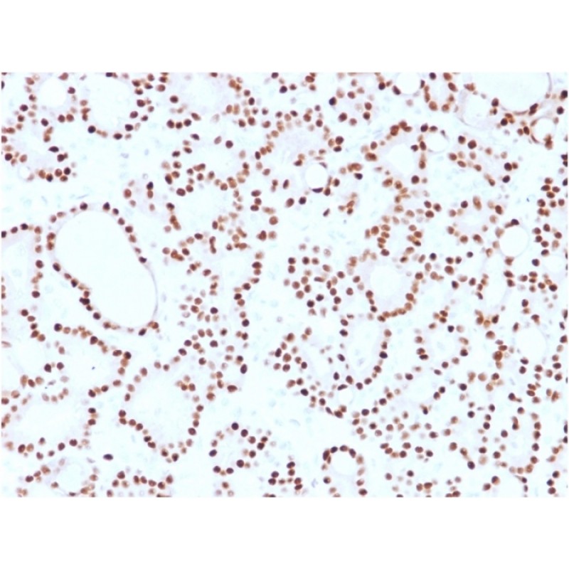 Cyclin D1 (G1-Cyclin & Mantle Cell Lymphoma Marker)(CCND1/2593), CF640R conjugate, 0.1mg/mL