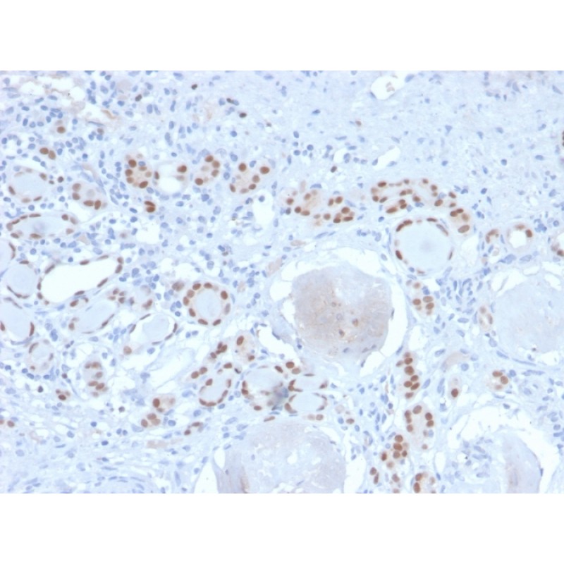 PAX8 (Renal Cell Marker)(PAX8/2774R), CF640R conjugate, 0.1mg/mL