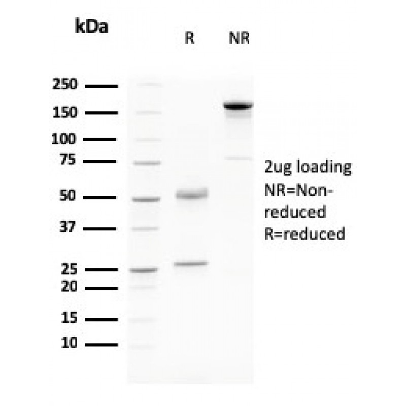 Desmoglein-3 (Squamous Cell Marker)(DSG3/2796), CF640R conjugate, 0.1mg/mL