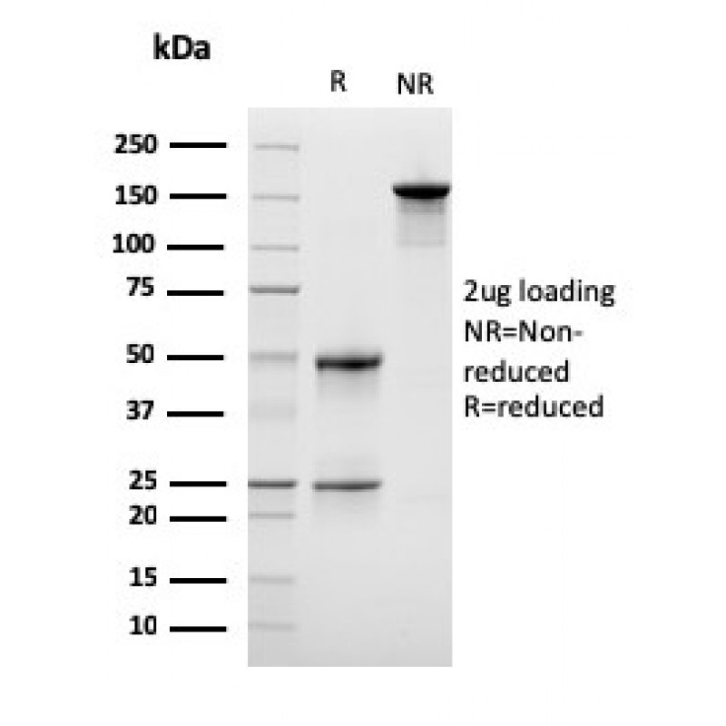 Lymphocyte Specific Protein 1 (LSP1) / pp52(LSP1/3042), CF640R conjugate, 0.1mg/mL