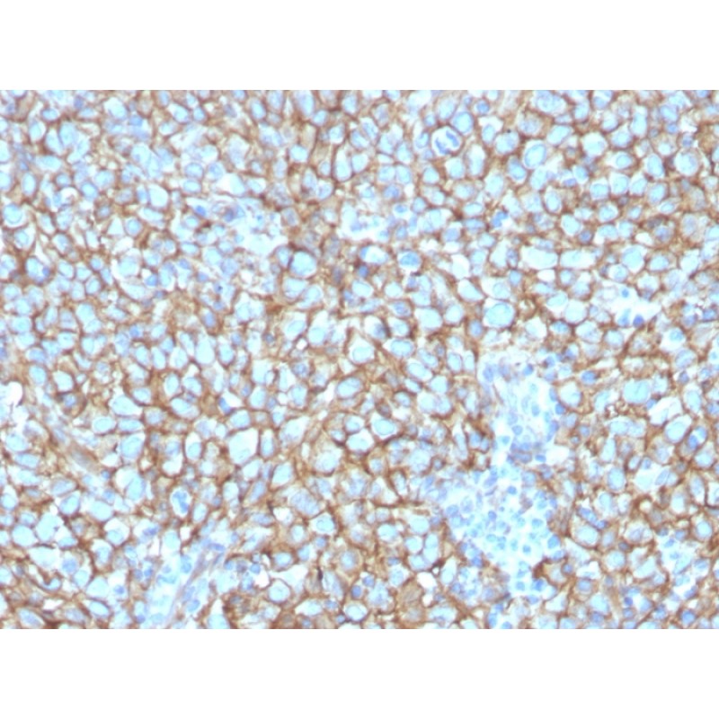 MCAM (Melanoma Cell Adhesion Molecule) / MUC18 / CD146(MCAM/3048), CF640R conjugate, 0.1mg/mL