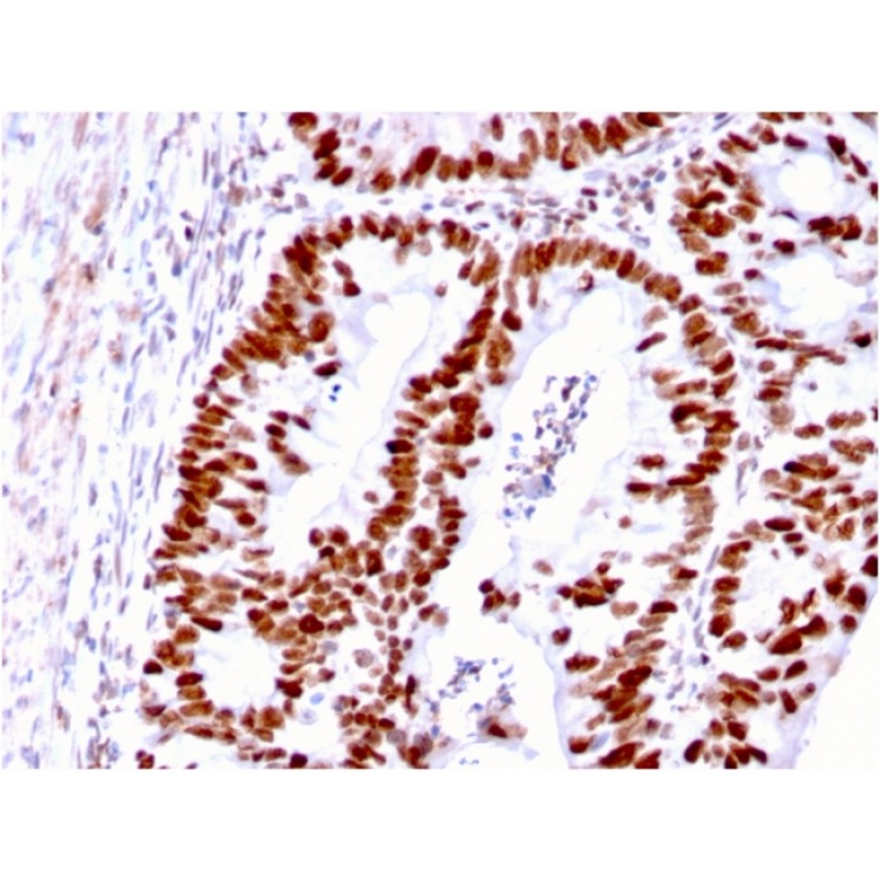 MSH6 (DNA Mismatch Repair Protein)(MSH6/3085), CF640R conjugate, 0.1mg/mL
